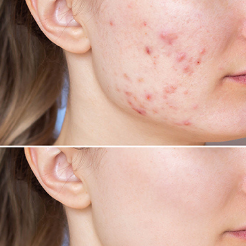 25 - Momme, 100% pure Mulberry silk.